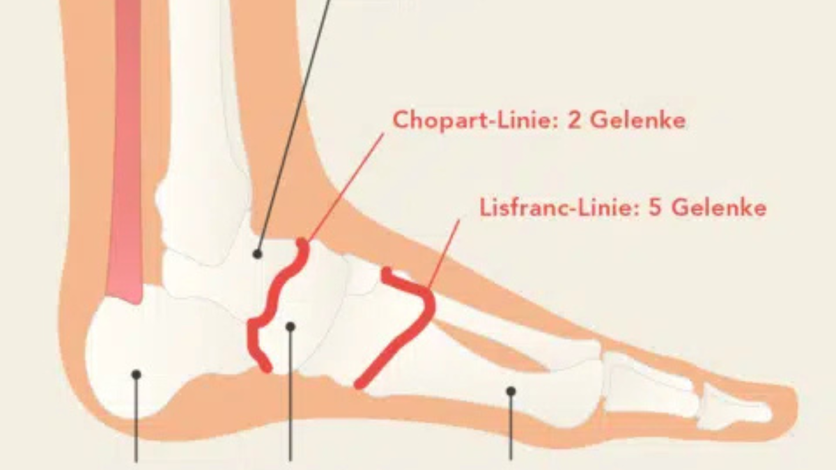 arthrose im fuß was hilft hausmittel